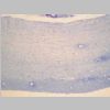 Intestino Delgado 11.jpg